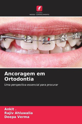 Ancoragem em Ortodontia