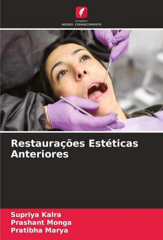 Restaurações Estéticas Anteriores