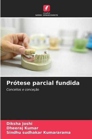 Prótese parcial fundida
