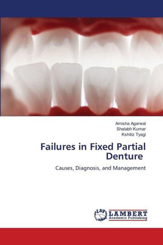 Failures in Fixed Partial Denture