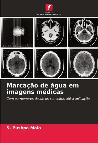 Marcação de água em imagens médicas