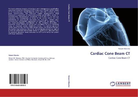 Cardiac Cone Beam CT