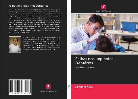Falhas nos Implantes Dentários