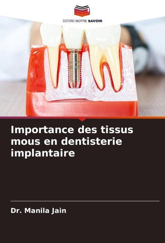 Importance des tissus mous en dentisterie implantaire