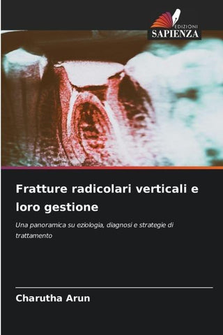 Fratture radicolari verticali e loro gestione
