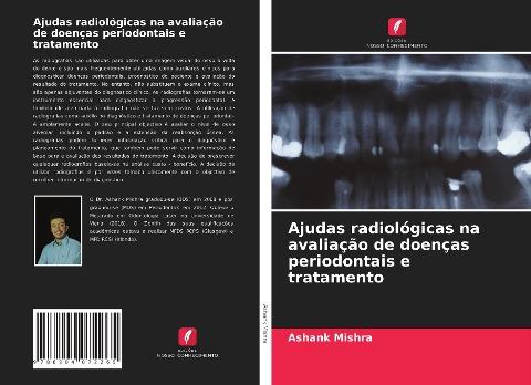 Ajudas radiológicas na avaliação de doenças periodontais e tratamento