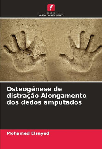 Osteogénese de distração Alongamento dos dedos amputados