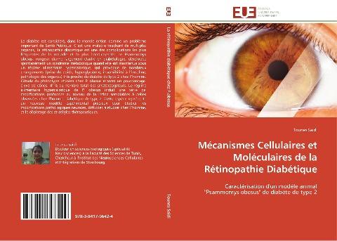 Mécanismes Cellulaires et Moléculaires de la Rétinopathie Diabétique