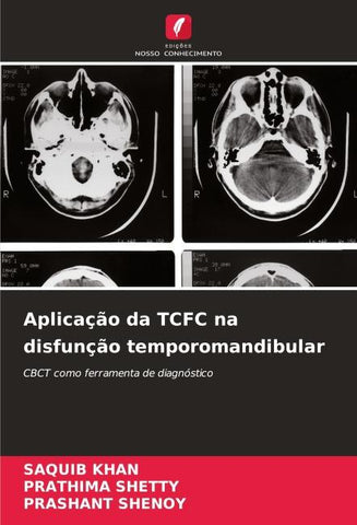 Aplicação da TCFC na disfunção temporomandibular