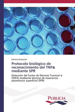 Protocolo biológico de reconocimiento del TNF¿ mediante SPR