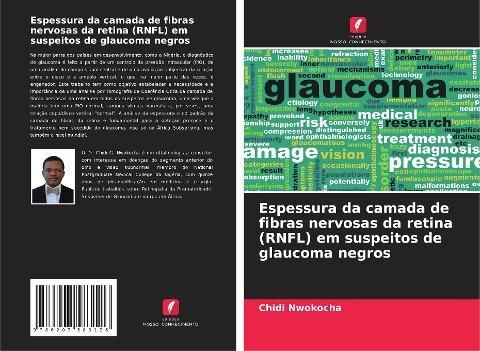 Espessura da camada de fibras nervosas da retina (RNFL) em suspeitos de glaucoma negros