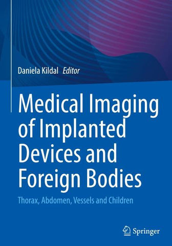 Medical Imaging of Implanted Devices and Foreign Bodies
