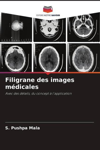 Filigrane des images médicales