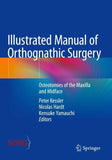 Illustrated Manual of Orthognathic Surgery