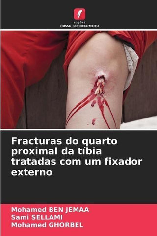 Fracturas do quarto proximal da tíbia tratadas com um fixador externo
