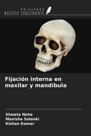 Fijación interna en maxilar y mandíbula