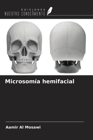 Microsomía hemifacial