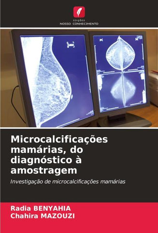 Microcalcificações mamárias, do diagnóstico à amostragem