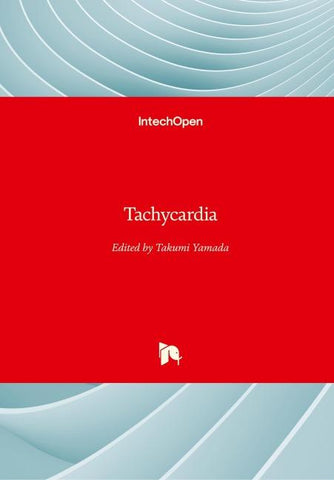 Tachycardia