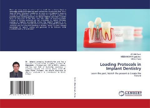 Loading Protocols in Implant Dentistry