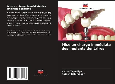 Mise en charge immédiate des implants dentaires