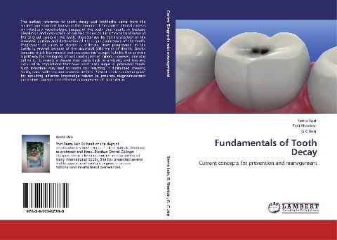 Fundamentals of Tooth Decay