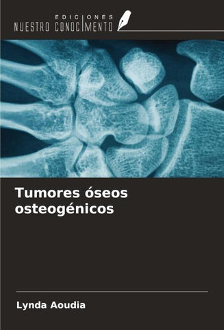 Tumores óseos osteogénicos