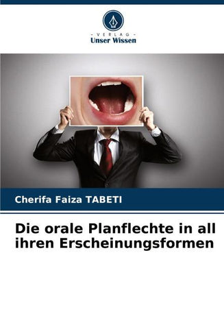 Die orale Planflechte in all ihren Erscheinungsformen