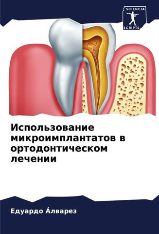 Ispol'zowanie mikroimplantatow w ortodonticheskom lechenii