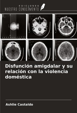 Disfunción amigdalar y su relación con la violencia doméstica