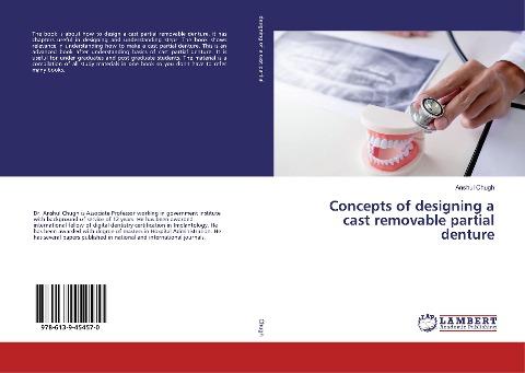 Concepts of designing a cast removable partial denture