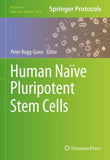 Human Naïve Pluripotent Stem Cells