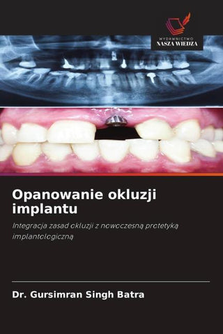 Opanowanie okluzji implantu