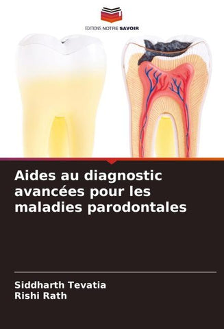 Aides au diagnostic avancées pour les maladies parodontales