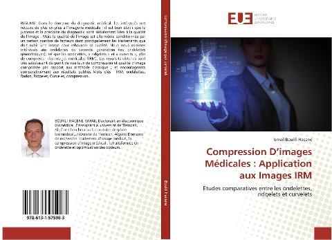 Compression D'images Médicales : Application aux Images IRM