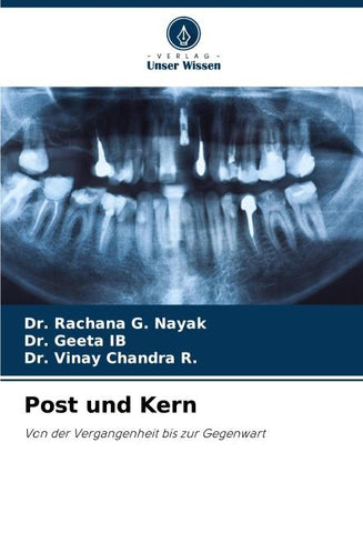 Post und Kern