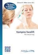 Vampire facelift