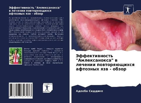 Jeffektiwnost' "Amlexanoxa" w lechenii powtorqüschihsq aftoznyh qzw - obzor