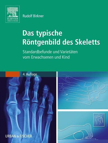 Das typische Röntgenbild des Skeletts