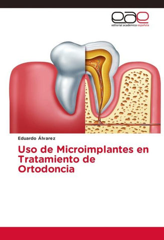 Uso de Microimplantes en Tratamiento de Ortodoncia