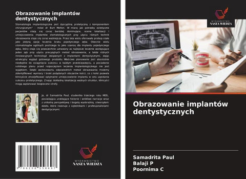 Obrazowanie implantów dentystycznych