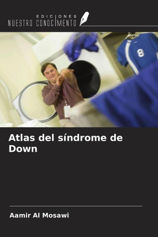 Atlas del síndrome de Down