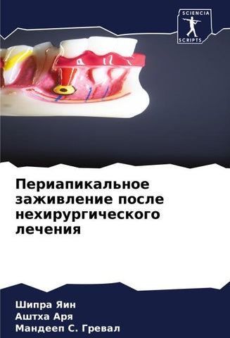 Periapikal'noe zazhiwlenie posle nehirurgicheskogo lecheniq