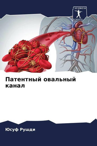 Patentnyj owal'nyj kanal