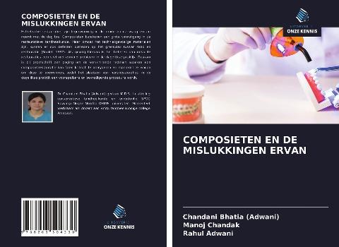 COMPOSIETEN EN DE MISLUKKINGEN ERVAN