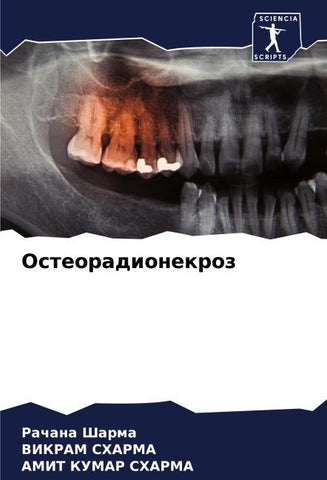 Osteoradionekroz