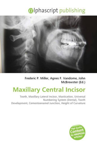 Maxillary Central Incisor
