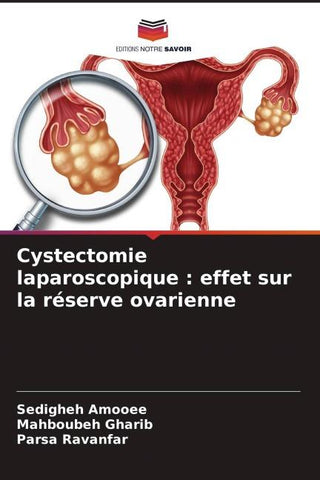 Cystectomie laparoscopique : effet sur la réserve ovarienne