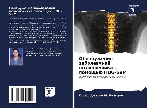 Obnaruzhenie zabolewanij pozwonochnika s pomosch'ü HOG-SVM