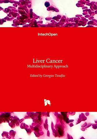 Liver Cancer - Multidisciplinary Approach